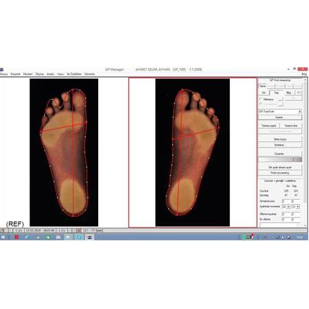 Foot Scanner Terminal