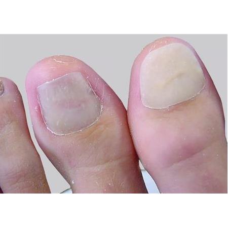 Unguisan Toz 30 ml Classic