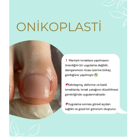 Unguisan Sıvı 30 ml